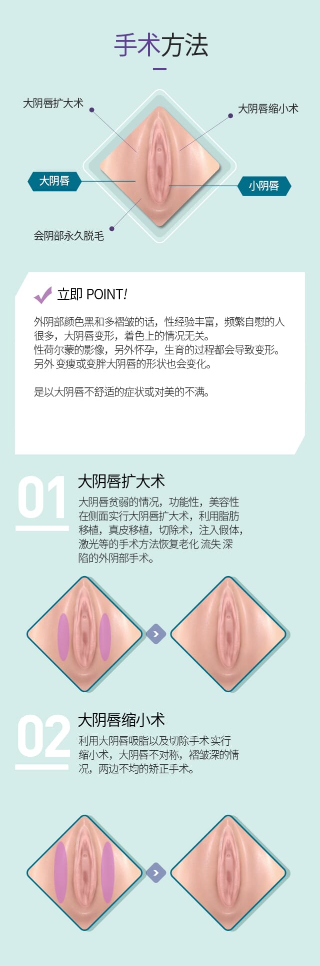 小阴唇 大阴唇整形-韩国如妍整形官网